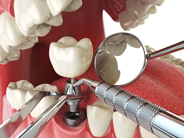 Best Emergency Dentist for Special Needs Patients in Burns, OR